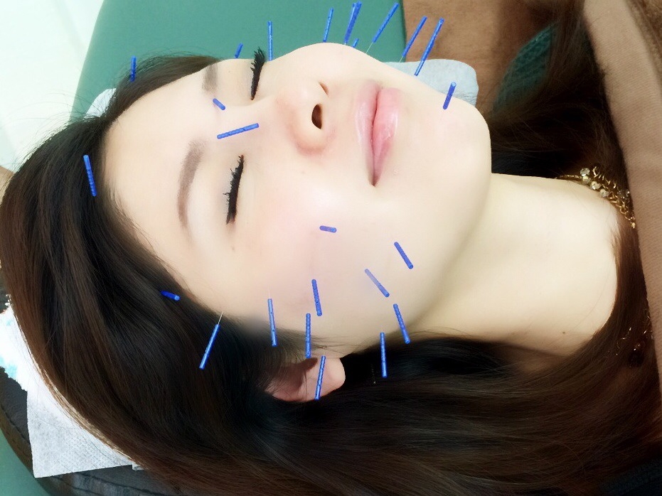 jC[W